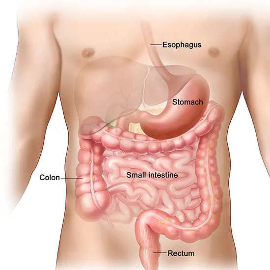 gastrointestinal stromal tumor